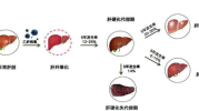 乙型肝炎症状,全面了解病毒性肝炎的典型表现